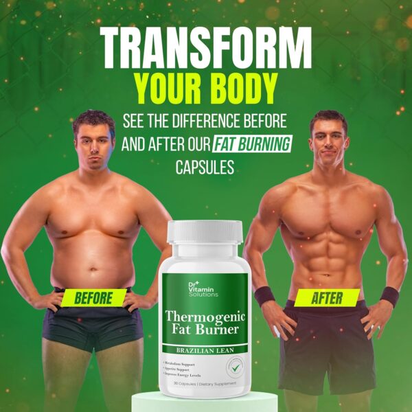 DR VITAMIN SOLUTIONS Thermogenic Fat Burner for Women and Men - Appetite Suppressant for Weight Loss - Includes Green Tea Extracts for Bloat Relief - Metabolism Booster - 30 Weight Loss Pills